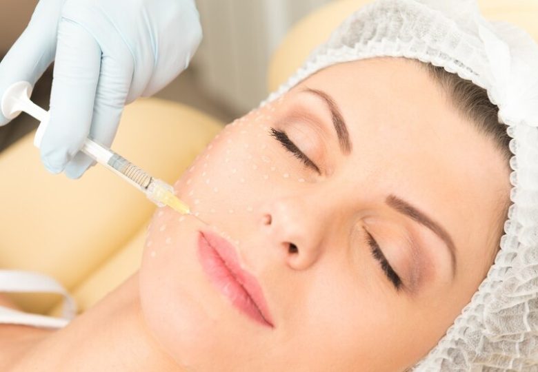 Skin booster injection points marked on a cheek